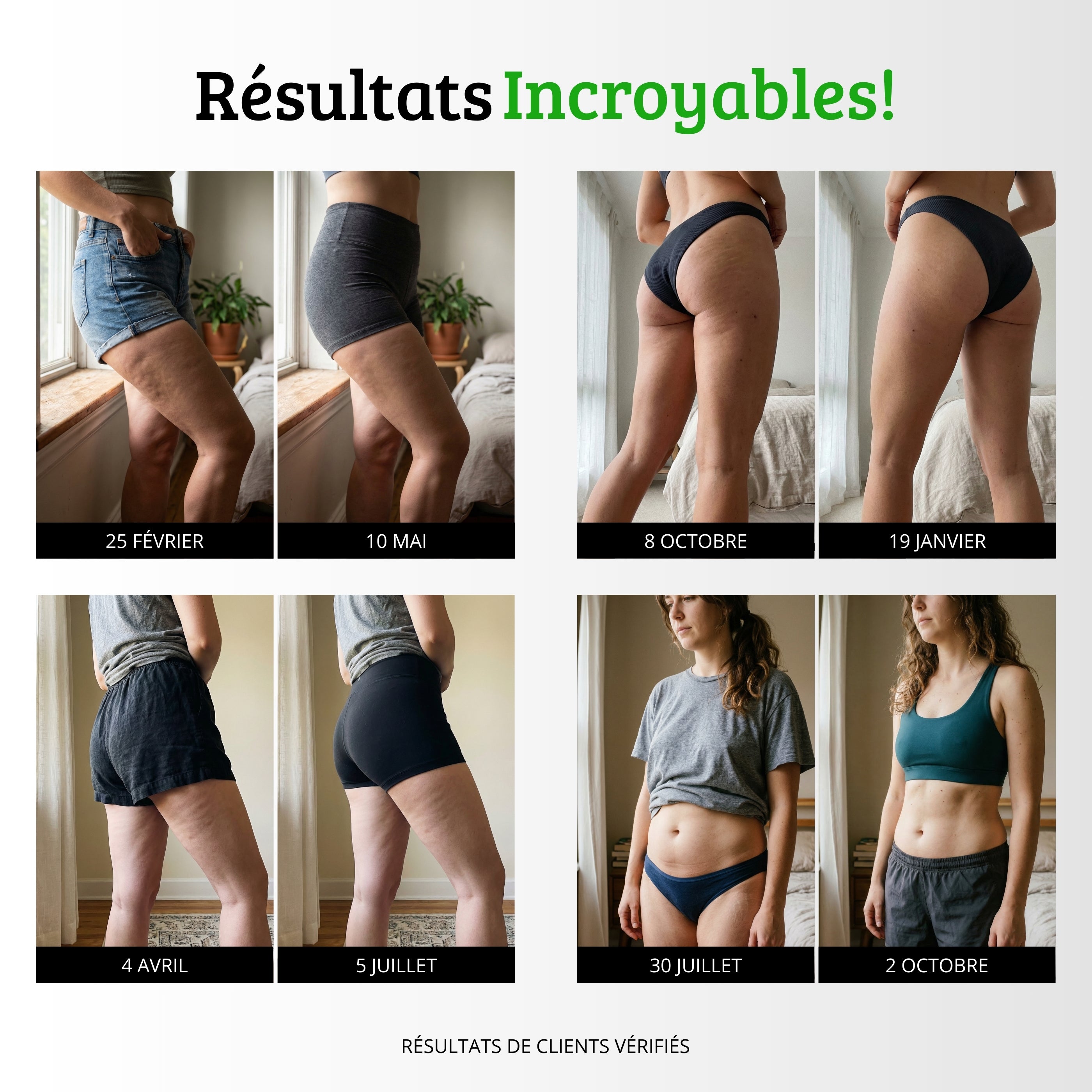 RENOVIE — Tecnologie 3D Anti-Cellulite